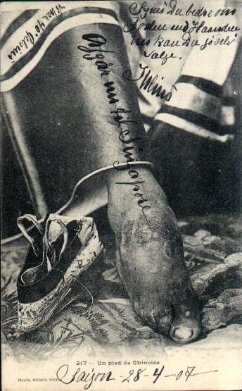 Στενά πόδια: Μια συνήθεια που βασάνισε και σκότωσε χιλιάδες Κινέζες [εικόνες] | iefimerida.gr 4