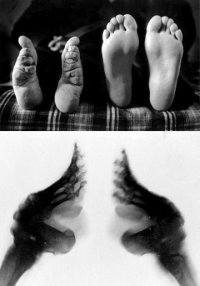 Στενά πόδια: Μια συνήθεια που βασάνισε και σκότωσε χιλιάδες Κινέζες [εικόνες] | iefimerida.gr 5