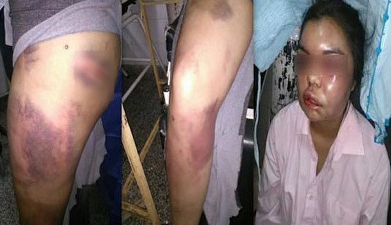 Σκληρό: Εδερνε τη γυναίκα του για κάθε like που έπαιρνε στο Facebook [εικόνες] | iefimerida.gr 2