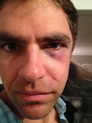 Παράνοια στις ΗΠΑ -Αστυνομικοί έκαναν ηλεκτροσόκ σε κωφάλαλο γιατί θεώρησαν πως τους κορόιδευε [εικόνα] | iefimerida.gr 0