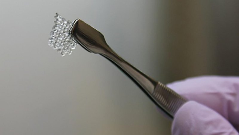 Επανάσταση: Τεχνικές προσθετικές ωοθήκες για γυναίκες που έχουν χάσει τη γονιμότητά τους [εικόνα]  | iefimerida.gr 0