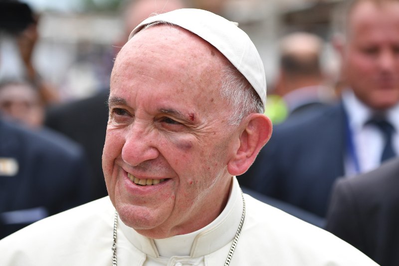 Επεσε και χτύπησε ο πάπας Φραγκίσκος -Τραυματίστηκε στο κεφάλι και το μάτι [εικόνες & βίντεο] | iefimerida.gr 0