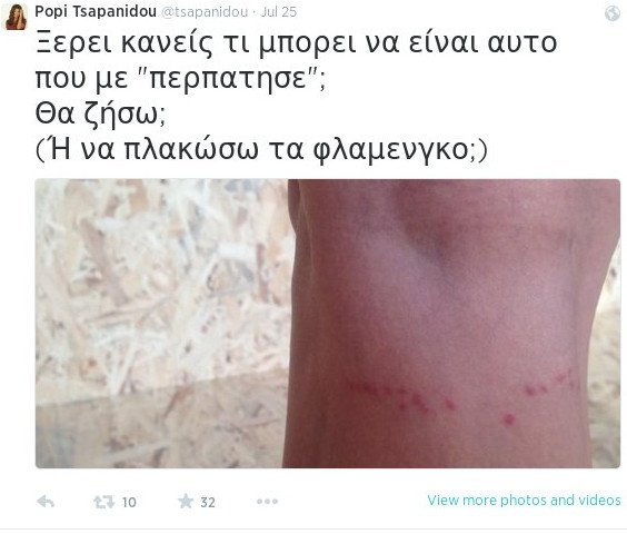 H Πόπη Τσαπανίδου ψάχνει τι είναι αυτό που...«περπάτησε» στο πόδι της -Η φωτογραφία που ανέβασε στο twitter | iefimerida.gr 0