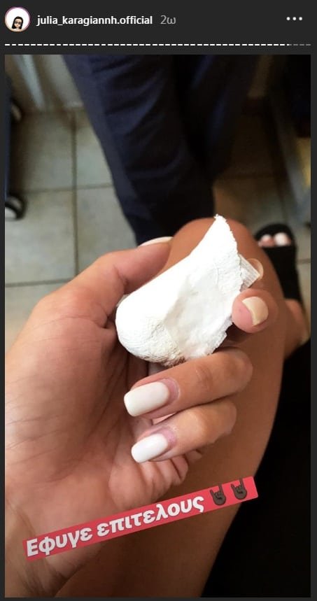 Η παίκτρια του Power of Love αποκάλυψε την καινούρια της μύτη [εικόνες] | iefimerida.gr 2