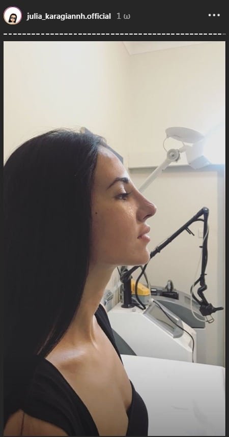 Η παίκτρια του Power of Love αποκάλυψε την καινούρια της μύτη [εικόνες] | iefimerida.gr 0