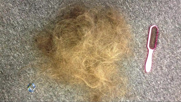 Δημοσιογράφος του BBC συγκλονίζει: Βγάζει δημοσίως την περούκα της, μετά τη χημειοθεραπεία [βίντεο] | iefimerida.gr 2