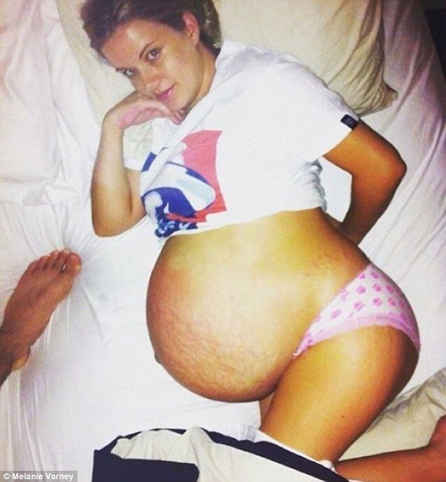  Πόζαρε γυμνή με ραγάδες και ατέλειες, αγκαλιά με τον άντρα της, μετά από 2 γέννες [εικόνες] | iefimerida.gr 0