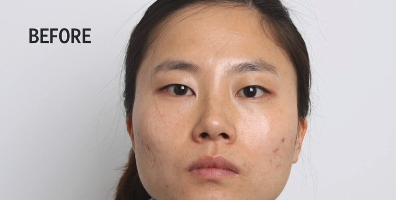 Νότια Κορέα: Βλεφαροπλαστική, η επέμβαση που κάνει θραύση [εικόνες] | iefimerida.gr 2