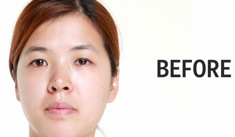 Νότια Κορέα: Βλεφαροπλαστική, η επέμβαση που κάνει θραύση [εικόνες] | iefimerida.gr 0