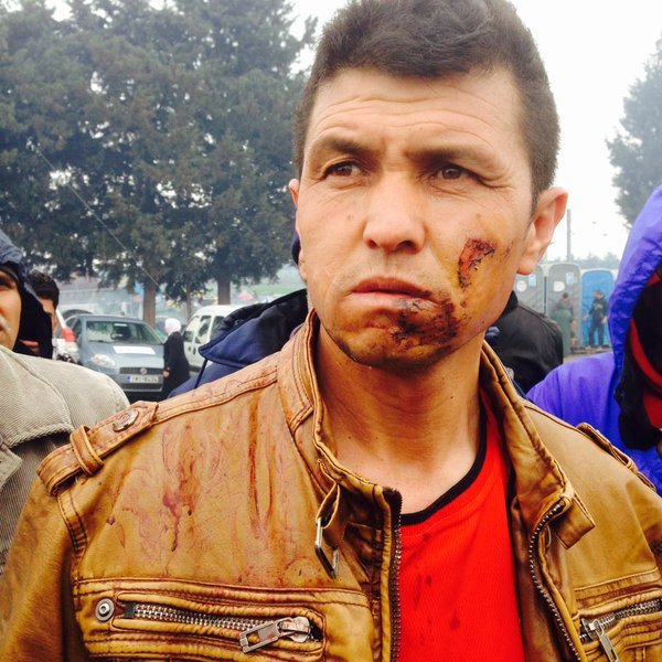 Μαρτυρία: Οι Σκοπιανοί ξυλοφόρτωσαν τους πρόσφυγες πριν τους στείλουν πίσω στην Ειδομένη [εικόνες] | iefimerida.gr 1