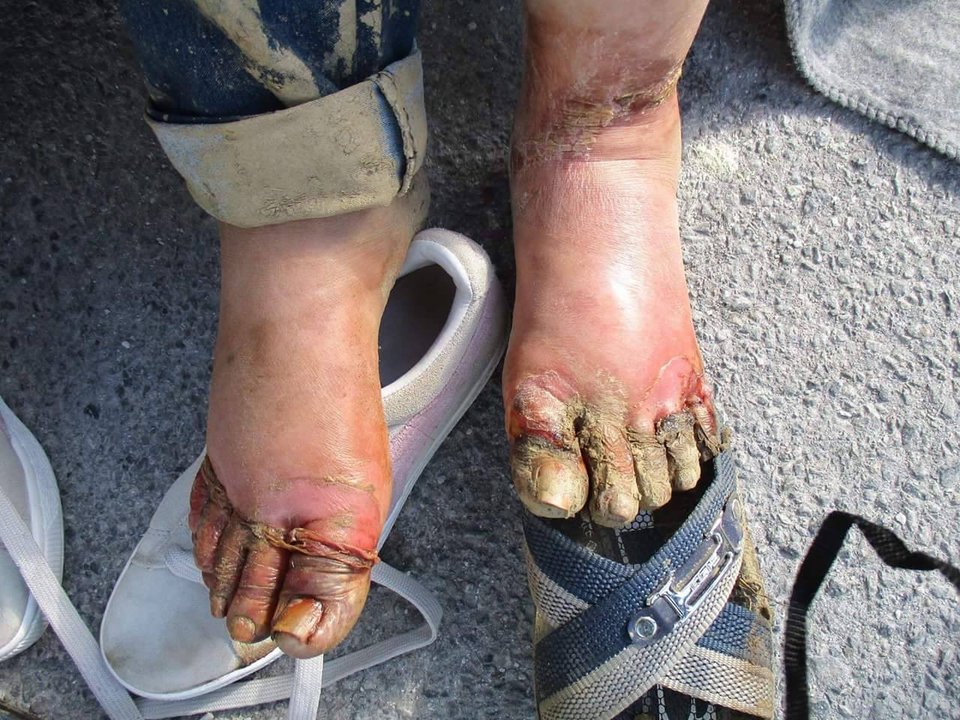 Εικόνες σοκ: Πρόσφυγες με κρυοπαγήματα στα πόδια -Με σαγιονάρες στους πάγους [εικόνες] | iefimerida.gr 2