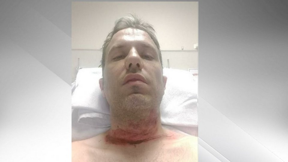 Ελληνο-Καναδός παριστάνει ότι κόπηκε ο λαιμός του και κάνει έρανο μέσω ίντερνετ [εικόνες] | iefimerida.gr 0