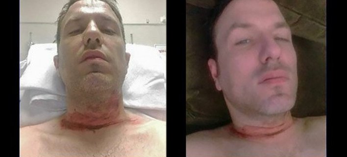 Ελληνο-Καναδός παριστάνει ότι κόπηκε ο λαιμός του και κάνει έρανο μέσω ίντερνετ [εικόνες] | iefimerida.gr 1