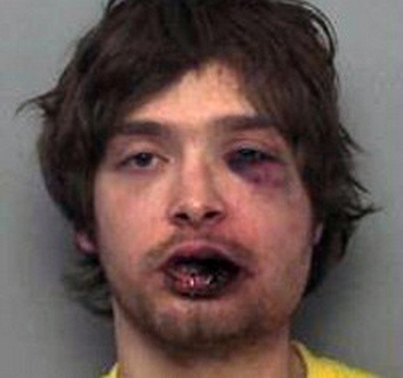 Επίδοξος διαρρήκτης πήγε να κλέψει συνταξιούχο πυγμάχο και «έφαγε της χρονιάς του» [εικόνες] | iefimerida.gr 0