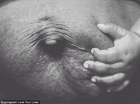 Περήφανες για τις «γραμμές» τους: Η σελίδα στο Instagram που πλημμύρισε με φωτογραφίες γυναικών έτσι όπως πραγματικά είναι -Γεμάτες ραγάδες [εικόνες] | iefimerida.gr 10