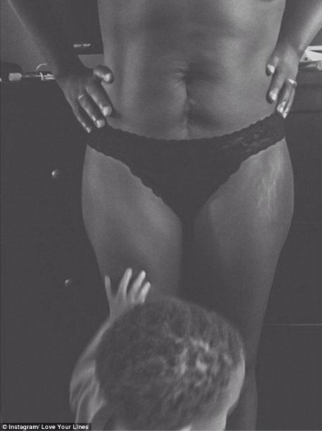 Περήφανες για τις «γραμμές» τους: Η σελίδα στο Instagram που πλημμύρισε με φωτογραφίες γυναικών έτσι όπως πραγματικά είναι -Γεμάτες ραγάδες [εικόνες] | iefimerida.gr 11