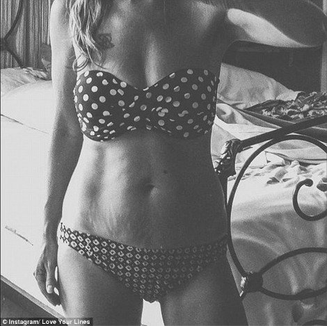 Περήφανες για τις «γραμμές» τους: Η σελίδα στο Instagram που πλημμύρισε με φωτογραφίες γυναικών έτσι όπως πραγματικά είναι -Γεμάτες ραγάδες [εικόνες] | iefimerida.gr 12