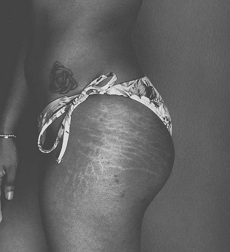 Περήφανες για τις «γραμμές» τους: Η σελίδα στο Instagram που πλημμύρισε με φωτογραφίες γυναικών έτσι όπως πραγματικά είναι -Γεμάτες ραγάδες [εικόνες] | iefimerida.gr 1