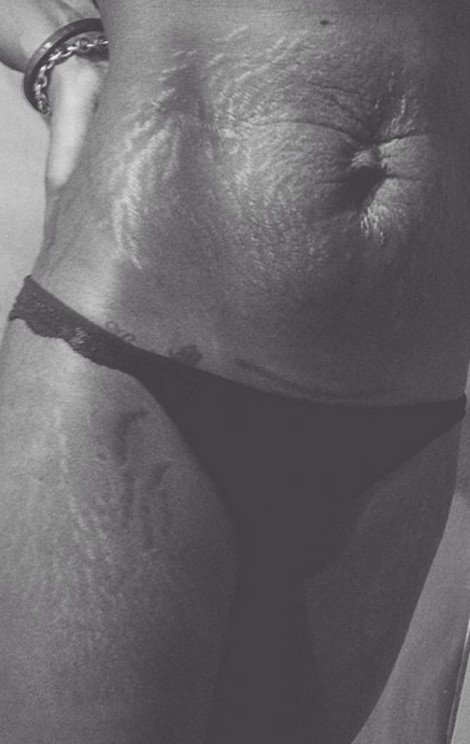 Περήφανες για τις «γραμμές» τους: Η σελίδα στο Instagram που πλημμύρισε με φωτογραφίες γυναικών έτσι όπως πραγματικά είναι -Γεμάτες ραγάδες [εικόνες] | iefimerida.gr 2