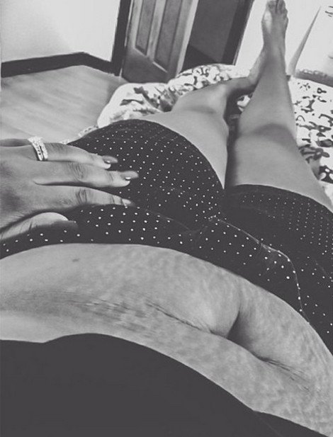 Περήφανες για τις «γραμμές» τους: Η σελίδα στο Instagram που πλημμύρισε με φωτογραφίες γυναικών έτσι όπως πραγματικά είναι -Γεμάτες ραγάδες [εικόνες] | iefimerida.gr 5