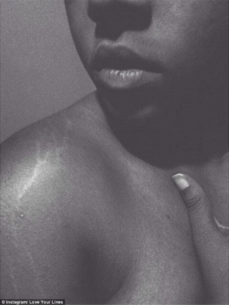 Περήφανες για τις «γραμμές» τους: Η σελίδα στο Instagram που πλημμύρισε με φωτογραφίες γυναικών έτσι όπως πραγματικά είναι -Γεμάτες ραγάδες [εικόνες] | iefimerida.gr 8