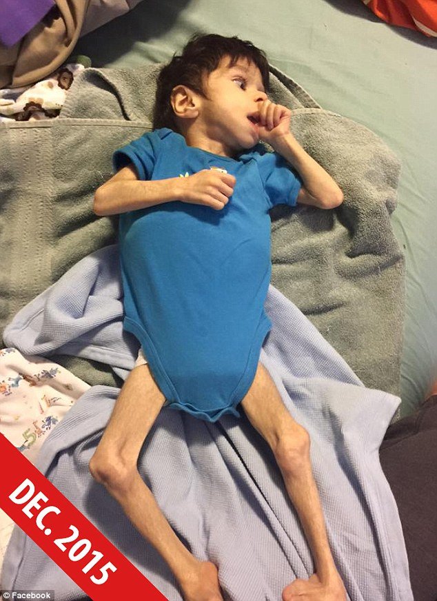 Εσωσαν 7χρονο αγόρι με ειδικές ανάγκες από τον θάνατο -Η μεταμόρφωσή του μέσα σε έναν χρόνο [εικόνες] | iefimerida.gr 0