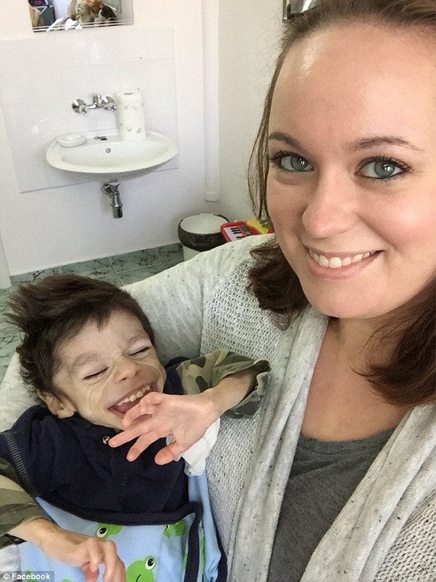 Εσωσαν 7χρονο αγόρι με ειδικές ανάγκες από τον θάνατο -Η μεταμόρφωσή του μέσα σε έναν χρόνο [εικόνες] | iefimerida.gr 3