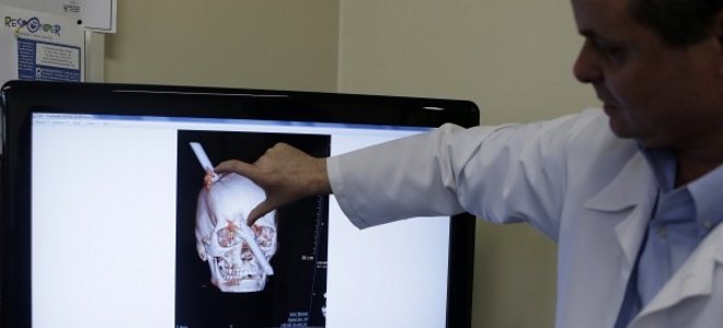 Του καρφώθηκε μία μεγάλη ράβδος στο κεφάλι αλλά αυτός επέζησε! [εικόνες] | iefimerida.gr 1