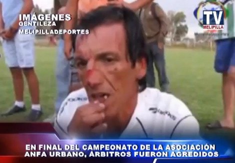 Απίστευτο ξύλο σε ερασιτεχνικό πρωτάθλημα ποδοσφαίρου στη Χιλή [εικόνες & βίντεο] | iefimerida.gr 0