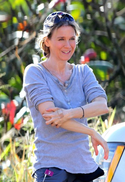 Η Renee Zellweger δεν μπορεί πια να γελάσει [εικόνες] | iefimerida.gr 9