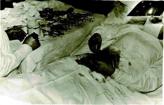 Λεονίντ Ρογκόζοφ: Ο σοβιετικός γιατρός που χειρούργησε μόνος του τον εαυτό του [εικόνες]   | iefimerida.gr 0