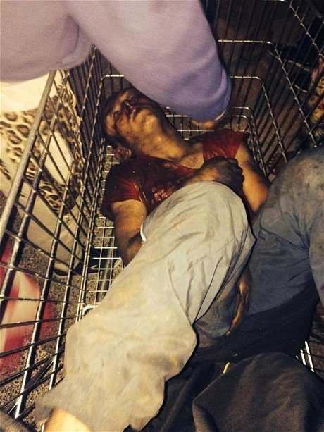 Η φωτογραφία που σόκαρε τη Γαλλία -Αιμόφυρτος και με παραμορφωμένο πρόσωπο ο 16χρονος Ρομά που ξυλοκοπήθηκε [εικόνες] | iefimerida.gr 1