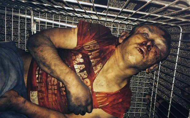 Η φωτογραφία που σόκαρε τη Γαλλία -Αιμόφυρτος και με παραμορφωμένο πρόσωπο ο 16χρονος Ρομά που ξυλοκοπήθηκε [εικόνες] | iefimerida.gr 0