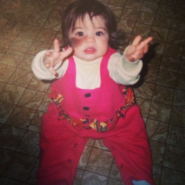 Πώς μια καλλονή με τριχωτό σημάδι εκ γενετής αγάπησε την ιδιαιτερότητά της και έγινε χορεύτρια [εικόνες]  | iefimerida.gr 7