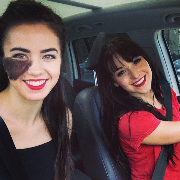 Πώς μια καλλονή με τριχωτό σημάδι εκ γενετής αγάπησε την ιδιαιτερότητά της και έγινε χορεύτρια [εικόνες]  | iefimerida.gr 4