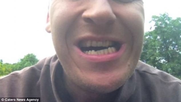 Δε σταματάει να μεγαλώνει το σαγόνι του -Μια αληθινά περίεργη πάθηση [εικόνες] | iefimerida.gr 0