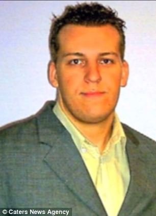 Δε σταματάει να μεγαλώνει το σαγόνι του -Μια αληθινά περίεργη πάθηση [εικόνες] | iefimerida.gr 1