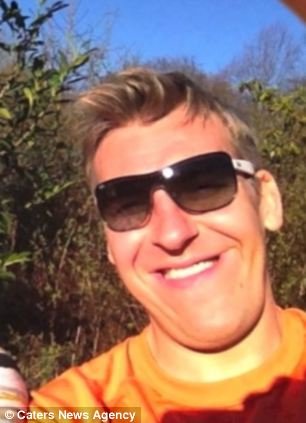 Δε σταματάει να μεγαλώνει το σαγόνι του -Μια αληθινά περίεργη πάθηση [εικόνες] | iefimerida.gr 3