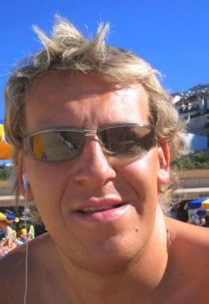 Δε σταματάει να μεγαλώνει το σαγόνι του -Μια αληθινά περίεργη πάθηση [εικόνες] | iefimerida.gr 4