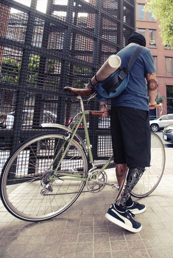 Η ζωή με ένα πρόσθετο τεχνητό μέλος-Σκληρά στιγμιότυπα από ανθρώπινες τραυματικές εμπειρίες [εικόνες]  | iefimerida.gr 3