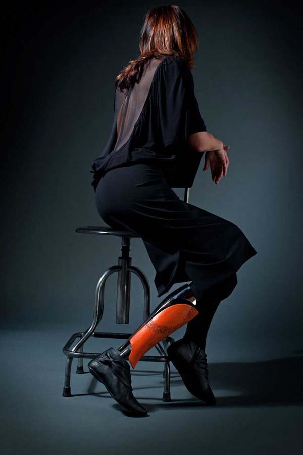 Η ζωή με ένα πρόσθετο τεχνητό μέλος-Σκληρά στιγμιότυπα από ανθρώπινες τραυματικές εμπειρίες [εικόνες]  | iefimerida.gr 9