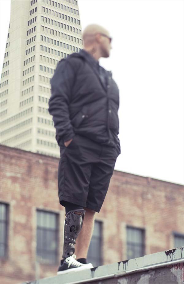 Η ζωή με ένα πρόσθετο τεχνητό μέλος-Σκληρά στιγμιότυπα από ανθρώπινες τραυματικές εμπειρίες [εικόνες]  | iefimerida.gr 10