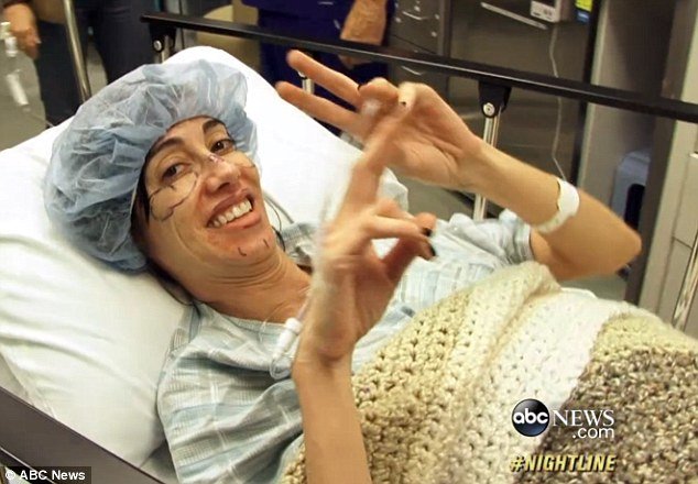 Μια αρρωστημένη εμμονή: Ξόδεψε 15.000 δολάρια σε πλαστικές εγχειρήσεις για να βγάζει καλύτερες selfies [εικόνες] | iefimerida.gr 1