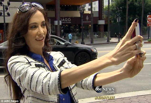 Μια αρρωστημένη εμμονή: Ξόδεψε 15.000 δολάρια σε πλαστικές εγχειρήσεις για να βγάζει καλύτερες selfies [εικόνες] | iefimerida.gr 3