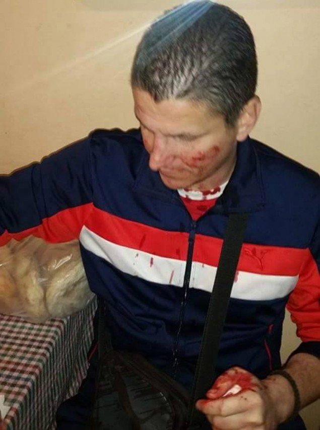 Εκτός ελέγχου η κατάσταση στα Βαλκάνια - Μαχαίρωσαν Σέρβους οπαδούς στα Σκόπια [εικόνες] | iefimerida.gr 0