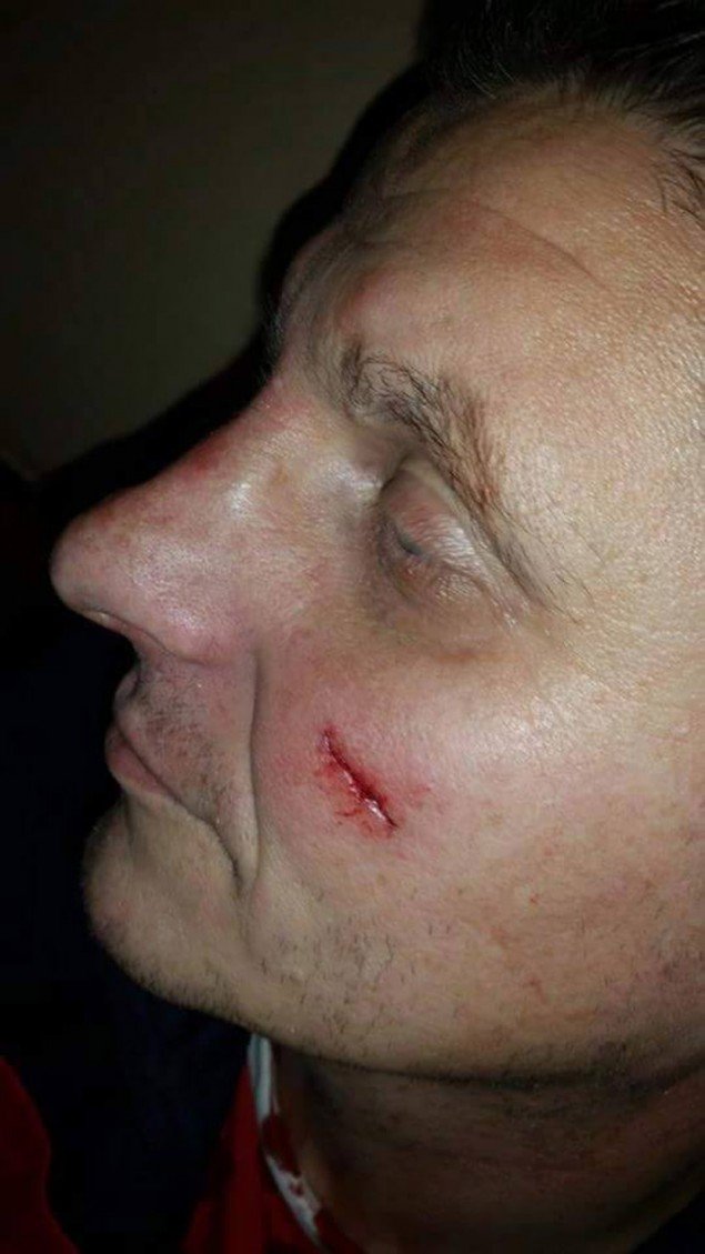 Εκτός ελέγχου η κατάσταση στα Βαλκάνια - Μαχαίρωσαν Σέρβους οπαδούς στα Σκόπια [εικόνες] | iefimerida.gr 1