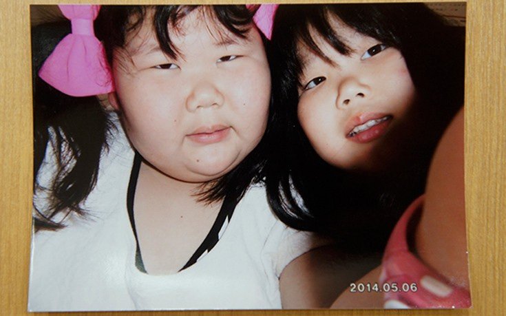 Στα άδυτα κλινικής για παχύσαρκα κορίτσια -Εκεί που η κάθε μπουκιά καταγράφεται [εικόνες]  | iefimerida.gr 2