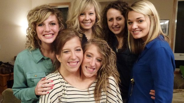 Η συγκινητική ιστορία των σιαμαίων από τη Μινεσότα που ζουν τη φυσιολογική ζωή δυο 20χρονων [εικόνες και βίντεο] | iefimerida.gr 0