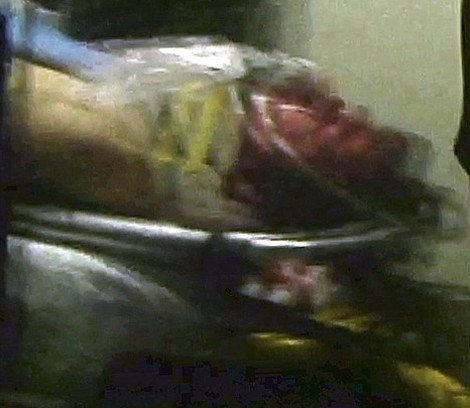 Η σύλληψη του 19χρονου, αιμόφυρτου, βομβιστή της Βοστώνης [εικόνες] | iefimerida.gr 3