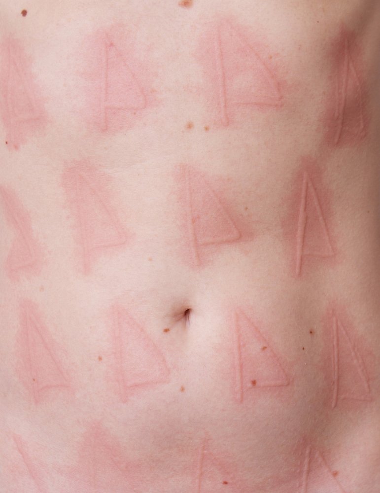 Εκανε τέχνη τη σπάνια πάθησή της και σαρώνει -Η πανέμορφη καλλιτέχνιδα με το σημαδεμένο σώμα [εικόνες] | iefimerida.gr 3